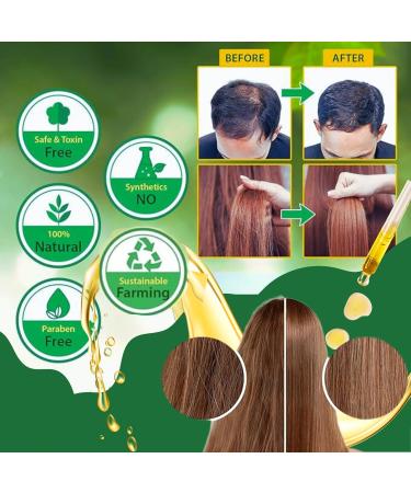 Organic Batana Rosemary Hair Growth Serum - Dr. Sebi Approved for Intensive Repair & Moisturized Scalp | Strengthen Thinning Hair - Buy Online on GoSupps.com