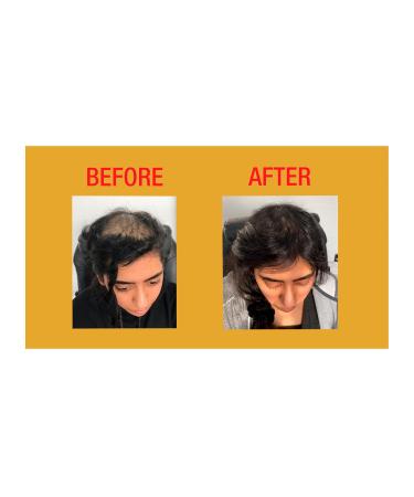 GOOD2GRO Hair Resuscitator & Edge Control - Regrow & Repair Thicker Edges | Vegan Cruelty-Free | International Shipping Available - Buy Online on GoSupps.com