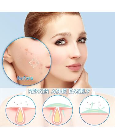 72 Invisible Hydrocolloid Acne Patches - Effective Anti-Acne Treatment for All Skin Types - Buy Online on GoSupps.com