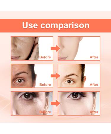 Advanced Deep Anti-Wrinkle Serum Pore Shrink Face Serum Hyaluronic Acid Moisturizing Nourish Essence Collagen Boost Anti-aging Serum - Buy Online on GoSupps.com
