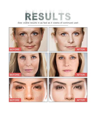 Buy Botox Face Serum | Botox Up Premium Anti-Aging Collagen Boost with Retinol Niacinamide Ceramides & Vitamin C - International Shipping - Buy Online on GoSupps.com