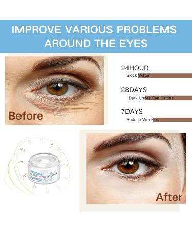 Coffee Extract Eye Cream Caffeine Eye Cream Under Eye Cream with Coffee and Hyaluronic Acid Anti Wrinkle Eye Cream Instant Eye Cream Tightener Eye Cream For Lines and Wrinkles And Dark Circles - Buy Online on GoSupps.com