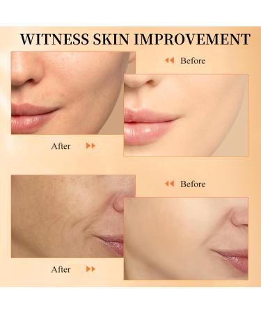 Face Serum for Women - Vitamin C Serum for Face - Dark Spot Correcting Glow Serum - Hydrating Serum with Hyaluronic Acid & Vitamin E - Anti Aging and Skin Brightening Serum Face 30ml - Buy Online on GoSupps.com