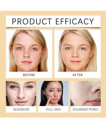 Gentle Foam Facial Cleanser - Deep Pore Cleaning Acne Treatment Oil Control & Hydration For Radiant Skin(1PCS) 1 Count (Pack of 1) - Buy Online on GoSupps.com