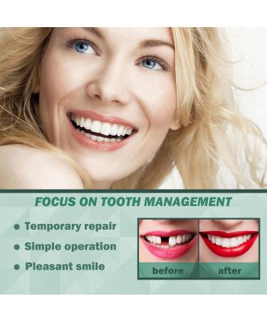Premium Dental Repair Kit for Broken Teeth | Tooth Filling & Repair | 60g Thermal Beads & Tweezers Included - Buy Online on GoSupps.com