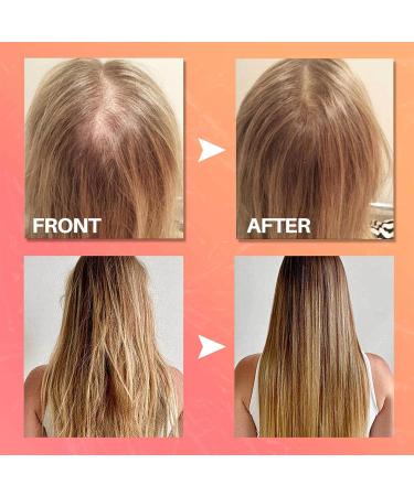 15 Batana Oil Apr s-shampoing Sans Rin age en Spray Revitalisant Sans Rin Age 100ml Batana Spray Cheveux Serum Lissant Hydratant pour les Cheveux Apr s-Shampoing R parateur - Buy Online on GoSupps.com