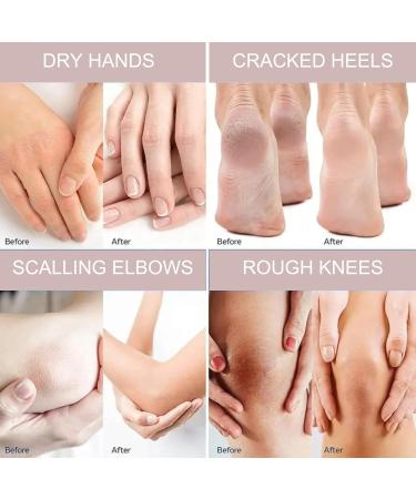 Urea 40% Foot Cream Urea Cream for Feet Cracked Heel Repair Cream Urea Cream 40 Percent Foot Moisturiser Cream Feet Hard Skin Remover Foot Callus Remover Nourishes Soften For Feet Knees Hand - Buy Online on GoSupps.com