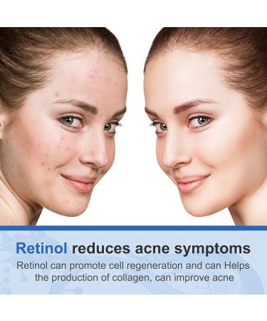 Retinol Face Cream Anti Wrinkle Face Cream Anti Aging Face Cream with 2.5% Retinol Hyaluronic Acid Vitamin E Night Face Cream for Women and Men - Buy Online on GoSupps.com