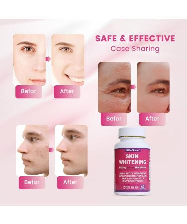 8000mg Glutathione Skin Whitening Tablets | Lighten Dark Spots & Acne Scars | 60 Tablets Supplement - Buy Online on GoSupps.com