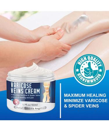Varicose Veins Cream - Natural Treatment for Legs, Improve Blood Circulation, Strengthen Capillaries & Relieve Tired Legs - Buy Online on GoSupps.com