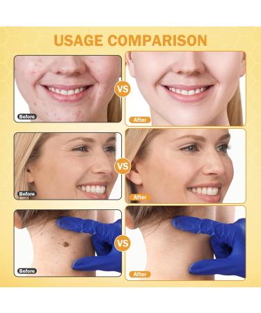 2PC Bee Venom Skin Treatment Cream Bee Venom Skin Restoration Cream Professional Anti-Wrinkle Firming Moisturising and Repairing for All Skin Typess - Buy Online on GoSupps.com