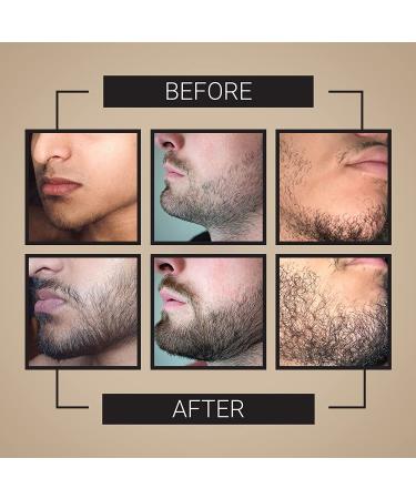 Crafted Beard Growth Kit - 3x Oil, Roller, Vitamins - Thicker Fuller Beard - 3 Month Supply - Buy Online on GoSupps.com