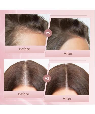 Hair Growth Serum for Men & Women | Effective Hair Loss Treatment | Fuller Thicker Healthier Hair - 1 Fl Oz - Buy Online on GoSupps.com