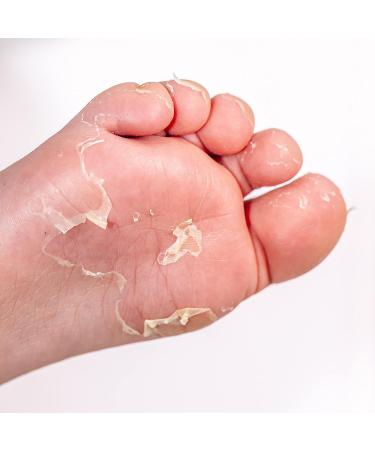 Onyx Professional Cracked Heel Stick & Foot Peel Mask Set for Smooth Baby Soft Feet - Buy Online on GoSupps.com