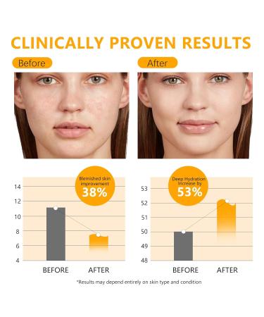 MAVENI High Concentration Snail Mucin Plumping Serum 100ml 3.38 fl.oz Hydrating Serum with Snail Reduce Wrinkles and Fine Lines Smooth Facial Skin - Buy Online on GoSupps.com