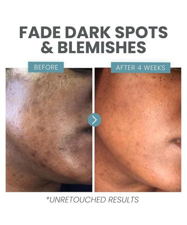 Vitamin C Plus Skin Clearing Serum - Anti-Aging & Brightening with Hyaluronic Acid & Retinol (1 oz) - Buy Online on GoSupps.com