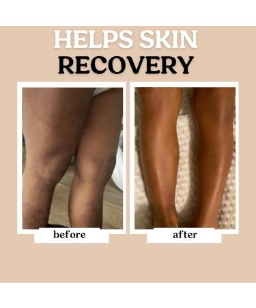 Roe Wellness Baby Lotion Moisturizer | Fragrance-Free & Lightweight | Ideal for Sensitive Skin | Safe for Infants Kids & More - Shop Now - Buy Online on GoSupps.com