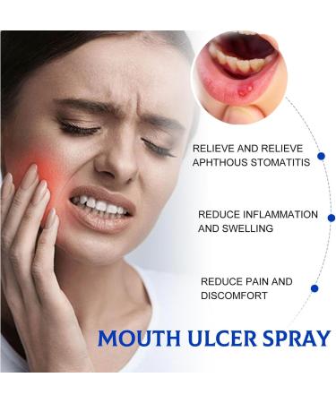 Mund Ulcers Spray - 30ml Mouth Spray for Gum Pain Relief | Refreshing Mint Taste | Fast-Acting Relief for Women and Men - Buy Online on GoSupps.com