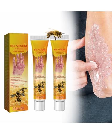 Youth Bee Venom Psoriasis Treatment Cream New Zealand Bee Venom Professional Psoriasis Treatment Cream Psoriasis Treatment Cream for All Skin Types (Size : 2PCS)