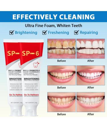 SP 6 Ultra Whitening Toothpaste - Probiotic Formula for Bright Smiles | 2pcs International Shipping - Buy Online on GoSupps.com
