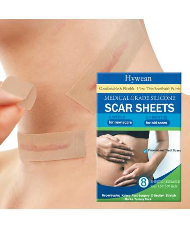 8 Pack Scar Away Silicone Scar Sheets - Breathable & Reusable Silicone Scar Tape - Buy Online on GoSupps.com