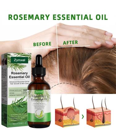 Cyxel Rosemary Oil - Boost Hair Growth Nourish Scalp & Soothing Skin Care for Aromatherapy Massage & Diffusers - Buy Online on GoSupps.com