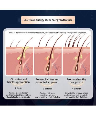 Mavdecll Wireless Hair Growth Cap Red Light Therapy Helmet for Hair Regrowth 210 LLLT 650nm Hair Loss Treatment for Men and Women - Buy Online on GoSupps.com