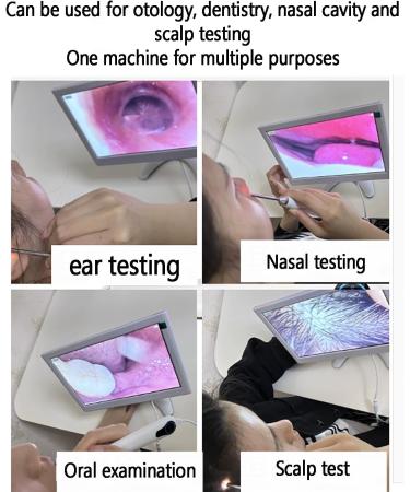 Professional Digital Otoscope Ear Wax Camera - 10 HD Display 3.2mm Lens 10MP Image & Screen Recording - Ideal for Adults | International Shipping Available - Buy Online on GoSupps.com