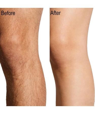  yikaiszh Set of 2 hair removal creams for sensitive skin for bikini line body and intimate areas nourishing and smoothing moisturizing treatment delays regrowth - Buy Online on GoSupps.com