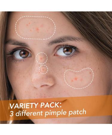 JOLVKA Large Pimple Patch XL - 116 Hydrocolloid Spot Dots Variety Pack for Face Blemishes - Zit Patches Stickers for Acne Cover Up - Buy Online on GoSupps.com