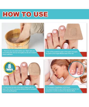 Toe Nail Patches for Fungus - Fast & Effective Nighttime Renewal | 16 Safe Fungal Nail Patches for Ultimate Foot Care - Buy Online on GoSupps.com