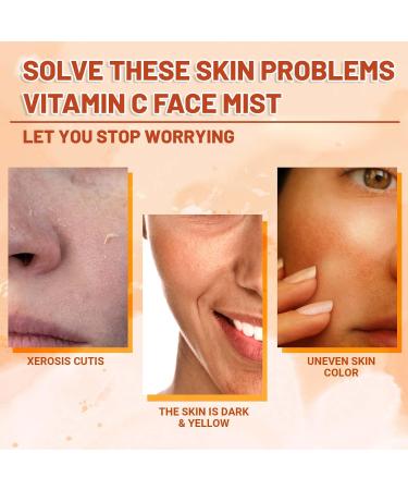 Vitamin C Face Mist VC Skin Brightening Facial Spray Skin Barrier Repair Improve Uneven Skin Relieves Dark Spots Spray Moisturiser VC Hydrating Serum Spray Deeply Moisturizing - Buy Online on GoSupps.com