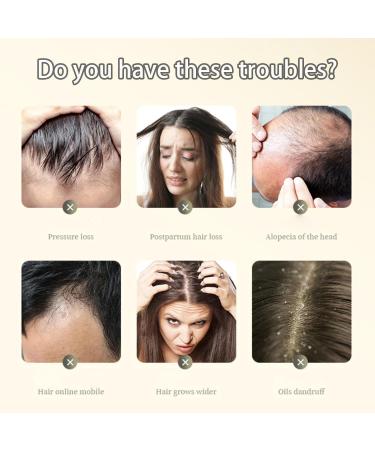 Ginger Plant Extract Anti-Hair Loss Hair Shampoo Plant Extract Ginger Shampoo for Hair Growth Ginger Anti Hair Loss Shampoo Oil Control Ginger Shampoo for Women & Men (1Box/200ML) - Buy Online on GoSupps.com