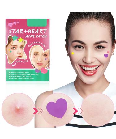 NOLLAM Pimple Patches for Face - 156 Hydrocolloid Acne Dots with Tea Tree & Calendula Oil - Star & Heart Shapes for Effective Zit Treatment - Buy Online on GoSupps.com