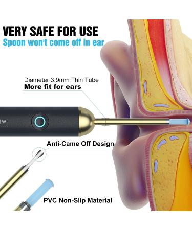 NIUQICT Ear Cleaner 1080P Camera with Lights - Ear Wax Removal Tool Kit 9 Pcs - Wireless Otoscope for Kids, Adults & Pets - Golden Black - Buy Online on GoSupps.com