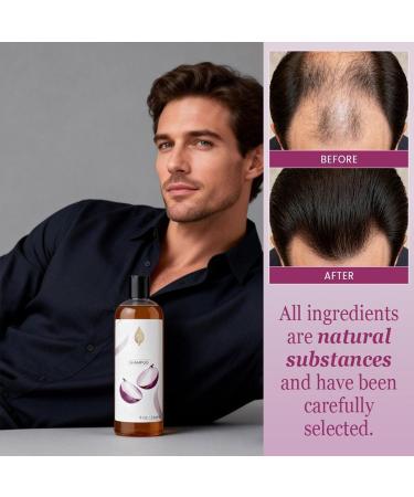 Onion Rosemary Shampoo Shampoing Biotine Oignon Romarin Shampoings Naturels L'huile Oignon Romarin Pour Pousse Des Cheveux Hydratant Nourrissant Shampoings Biotine Pousse Des Cheveux - Buy Online on GoSupps.com