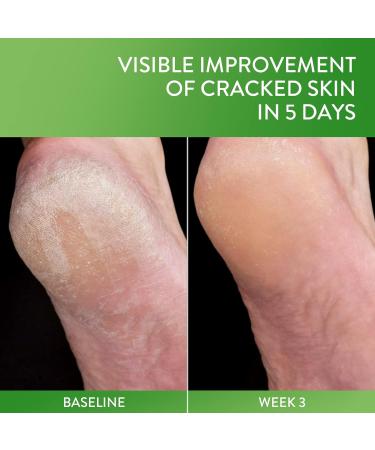 Cetaphil Cracked Skin Repair Balm 3 oz For Very Rough & Cracked Sensitive Skin Protects Soothes & Restores Deeper Cracks Hypoallergenic Fragrance Free (Packaging May Vary) 3 Ounce (Pack of 1) Cracked Skin 3oz - Buy Online on GoSupps.com