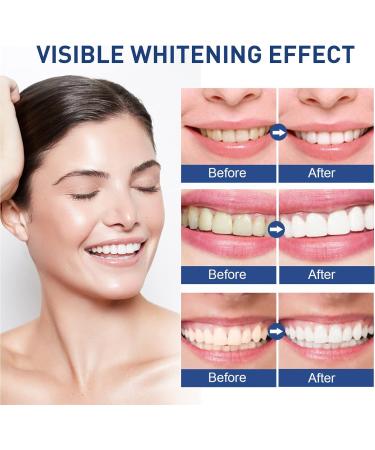 Teeth Whitening Pen & Gel Set | Effective Tooth Stain Removal | Teeth Whitening Essence | Blue - Buy Online on GoSupps.com