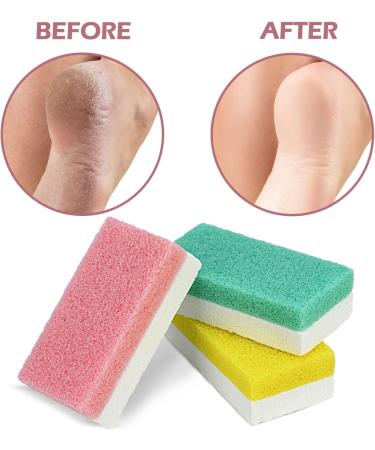 Pumice Stone for Feet - 2-in-1 Callus Remover & Exfoliator Tool - Pack of 6 - Buy Online on GoSupps.com