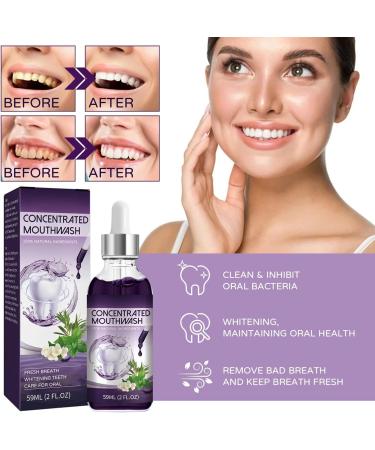 2024 New Tooth Mouth Rinsing Total Care Concentrated Mouthwash (3 PC) | Deep Cleaning Stain Removal & Fresh Breath - Buy Online on GoSupps.com