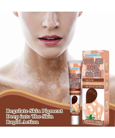JoanofArc Natural Vitiligo Cream 20g - Advanced Formula to target White Spots & Uneven Skin Tone Promotes Melanin Production Suitable for Men & Women - Buy Online on GoSupps.com