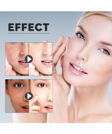 Hydrating Facial Toner - Fades Acne Marks/Spots Boosts Collagen Tightens Pores Brightens & Moisturizes Skin(2PCS) - Buy Online on GoSupps.com