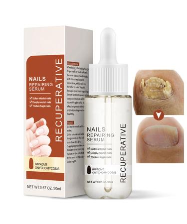 Nail Growth and Strengthening Serum 20ml Nails Repair Serum Fungal Nail Treatment for Toenail Extra Strong Toenail Growth Treatment for Repairing Damaged and Discolored Nails Improve Onychomycosis