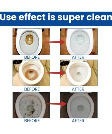 12pcs Toilet Cleaner Active Tablets Toilet Cleaner Toilet Bowl Cleaner Toilet Cleaning Tablets Deep Clean Toilet Descaler Heavy Duty Toilet Limescale Remover Strong Bleach Cleaner Toilet Deodoriser - Buy Online on GoSupps.com