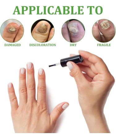 Nail Strengthener for Nail Growth Treatment Keratin 3 Day Growth Nail Treatment & Strengthener Nail Strengthener for Damaged Nails Nail Hardener for Weak Nails - Buy Online on GoSupps.com