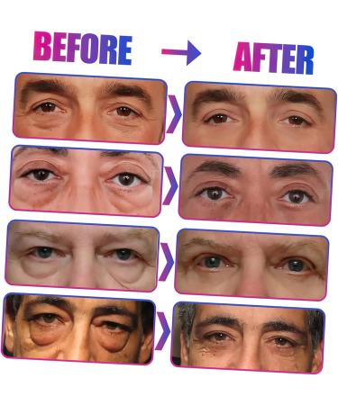 TOVINANNA 2 Eye Cream Eye Moisturizer Anti-wrinkle Eye Gel Men Skin Care Supplies Anti-aging Eye Bag Cream Man Abs - Buy Online on GoSupps.com