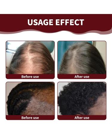 Xumann 120g Raw Batana Oil for Hair Growth Batana Oil Organic for Thicker Fuller Hair Nourishes Dry Scalp and Repair Damaged Hair - Buy Online on GoSupps.com