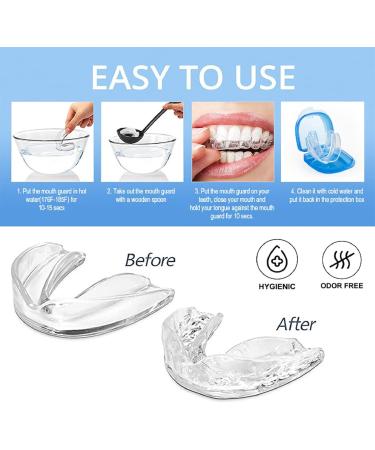 8-Piece Comfortable Mouth Protection for Teeth Grinding | Bite Rails & Night Guards - Available in 2 Sizes - Buy Online on GoSupps.com