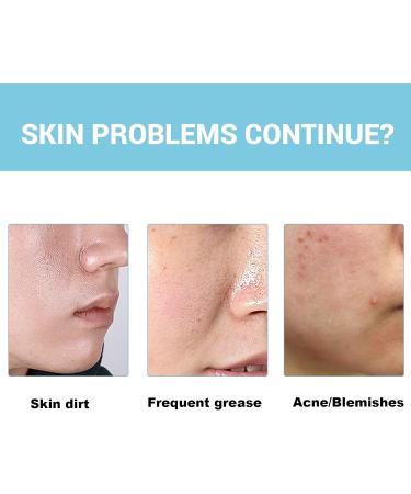 Nettoyant Visage Purifiant En Profondeur - Contr le Du S bum claircissant Et Resserre Les Pores For Une Peau Fra che Et Tonifi e - Buy Online on GoSupps.com