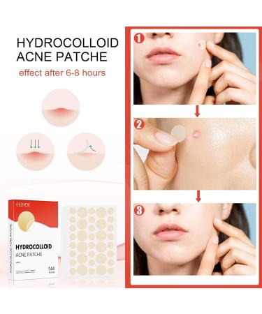 Hydrocolloid Acne Patches - 144 Invisible Spot Patches for Face & Body, 8mm & 12mm - Calms & Relieves Acne Quickly - Buy Online on GoSupps.com